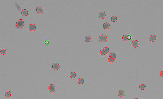 counting isolated nuclei using trypan blue