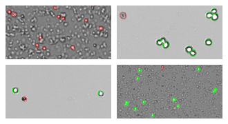 Collage of four different CellDrop result images with different cell types