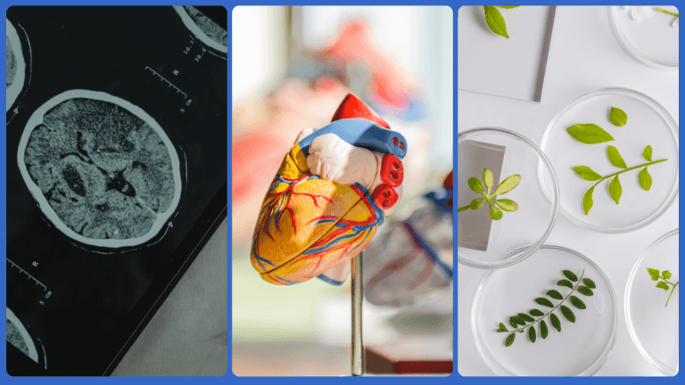 Exploring Key Applications of Single Nuclei RNA Sequencing