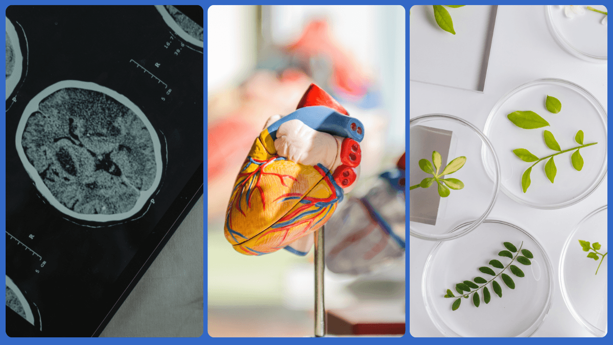 Exploring Key Applications of Single Nuclei RNA Sequencing Image