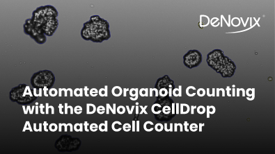 Automated Organoid Counting