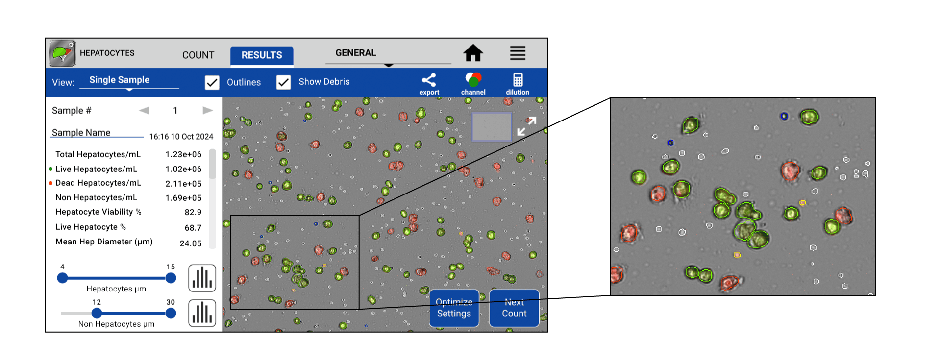 Hepatocyte-Pop-Out-Graphic-Horizontal Hepatocyte Count Result on the CellDrop Automated Cell Counter
